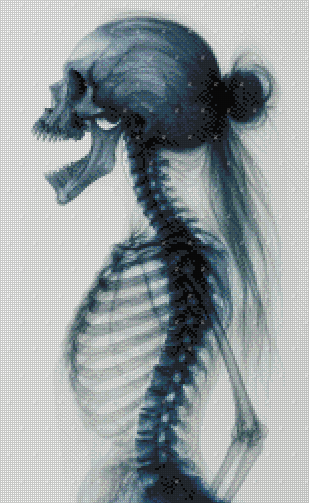 Pre-order The Xray